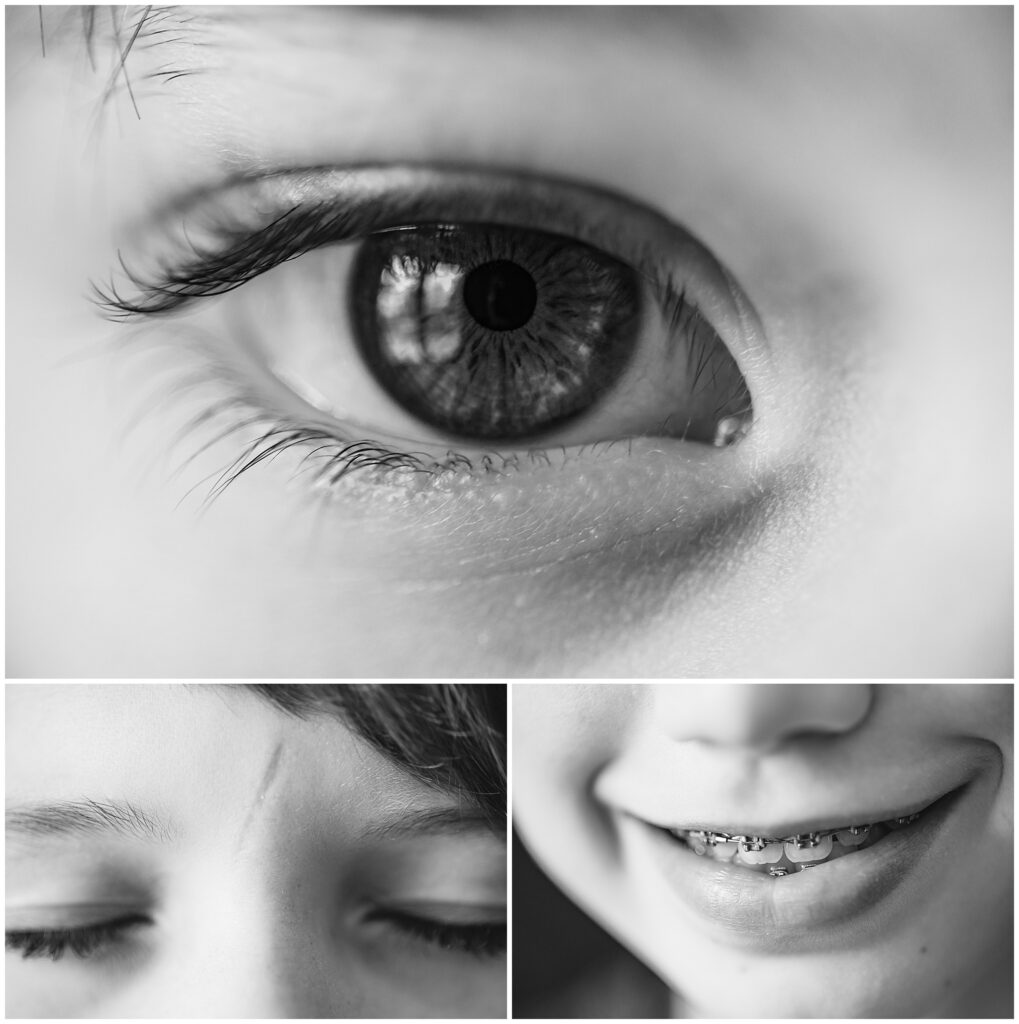 Close up Details of a little boy's eye, scar, and smile. Photo taken by Dripping Springs TX based Lydia Teague Photography. 